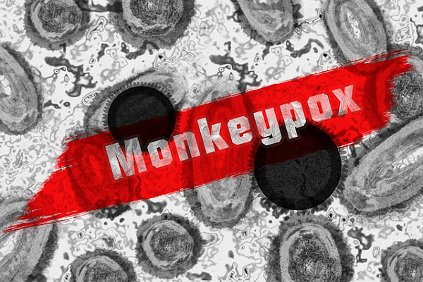 Antígeno de prueba de hisopo Harga: ¡Se han diagnosticado más de 1000 casos de monkeopox en muchos países!